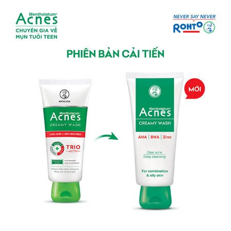 Kem Rửa Mặt Acnes Giúp Ngừa Mụn 100g 02
